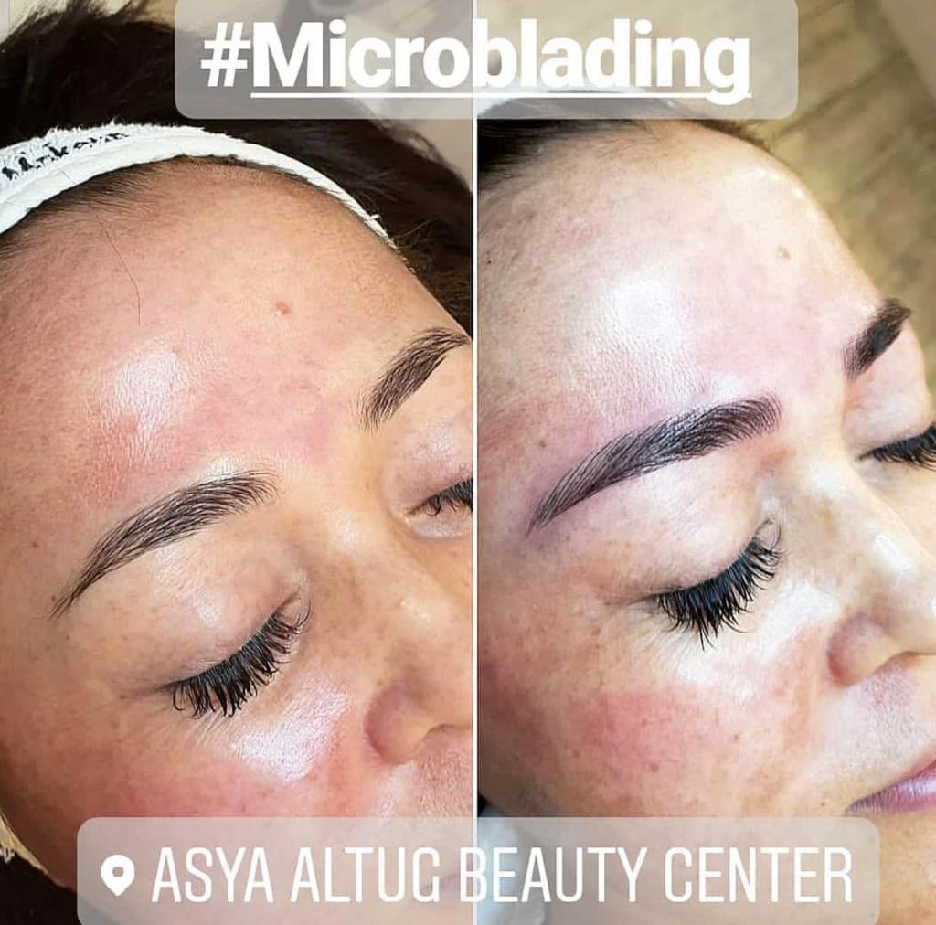 Microblading