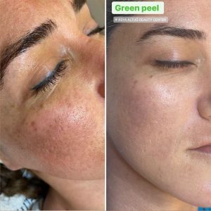 Asya Altuğ Green Peel
