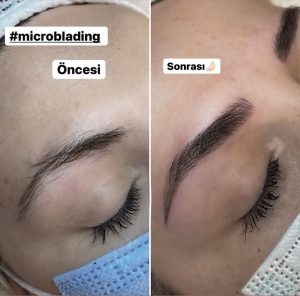 Microblading - Asya Altuğ