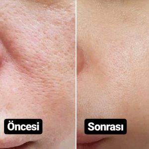 Beauty Center - Medikal Cilt Bakımı