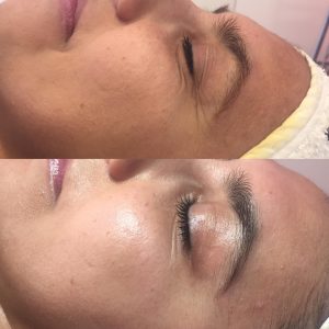 Medikal Cilt Bakımı - Beauty Center
