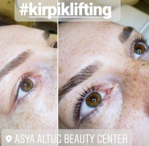 Antalya Kirpik Lifting