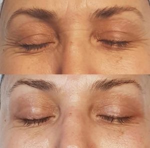 Asya Altuğ Beauty Center Göz Çevresi Bakımı