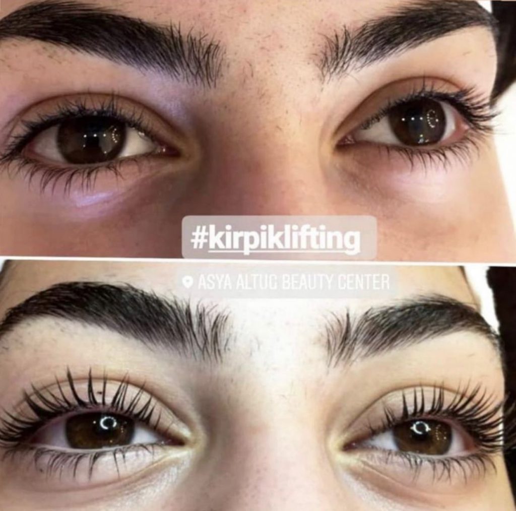 Kirpik Lifting Aşamaları