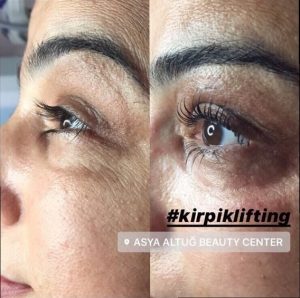 Kirpik Lifting - Antalya Güzellik Merkezi