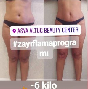 Antalya Vücut Bakım Uygulamaları - Zayıflama Programı